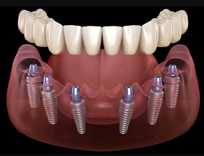 Philadelphia: dental treatments abroad